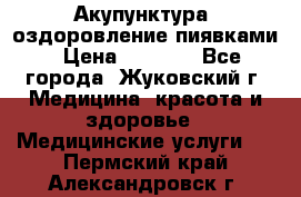 Акупунктура, оздоровление пиявками › Цена ­ 3 000 - Все города, Жуковский г. Медицина, красота и здоровье » Медицинские услуги   . Пермский край,Александровск г.